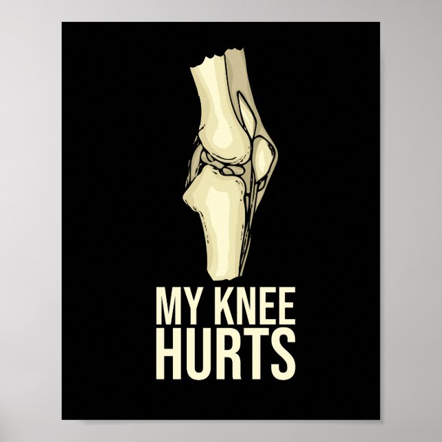 Knee Replacement Recovery Gift New Joint Surgery Poster (Front)