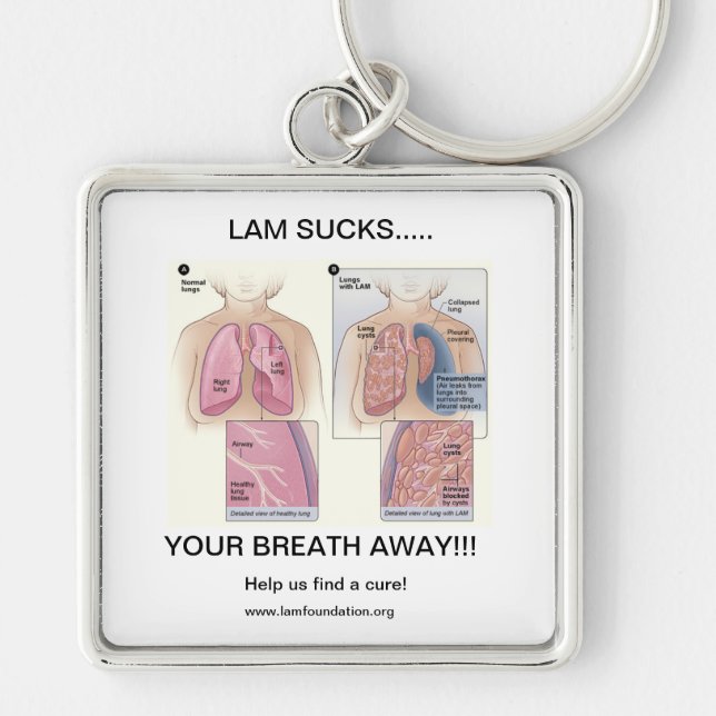 LAM SUCKS KEY RING (Front)