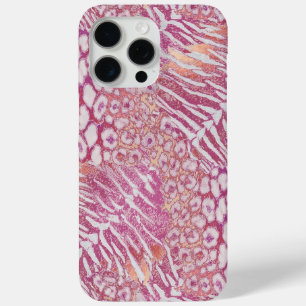 Leopard tiger skin trendy iPhone 15 pro max case