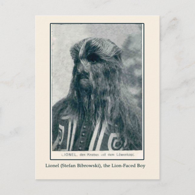 Lionel, the Lion Faced Boy Cards and Postcards (Front)