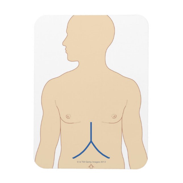 Liver Transplant Magnet (Vertical)