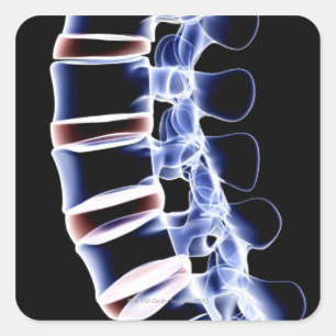 Lumbar Vertebrae 2 Square Sticker
