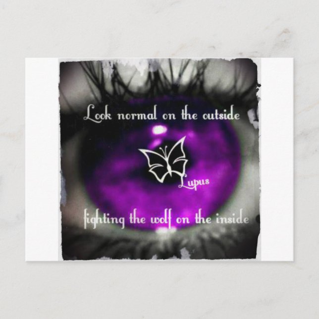 lupus eye22.jpg postcard (Front)