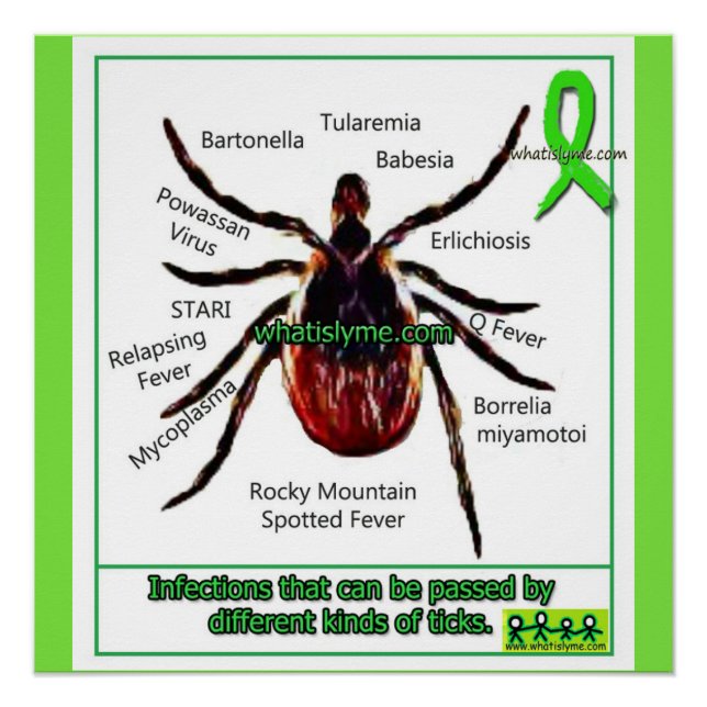 Lyme Disease & Co Infection Educational Chart (Front)