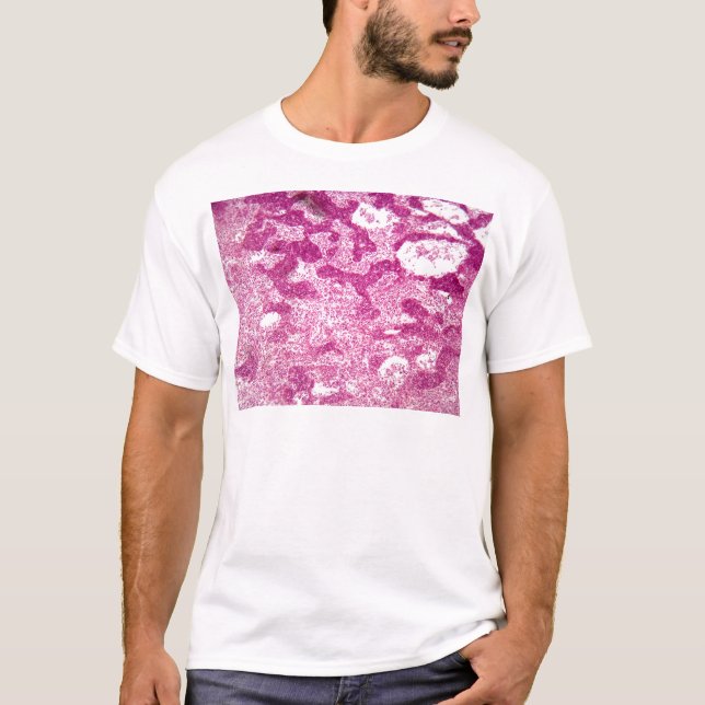 Lymph node cells under the microscope. T-Shirt (Front)