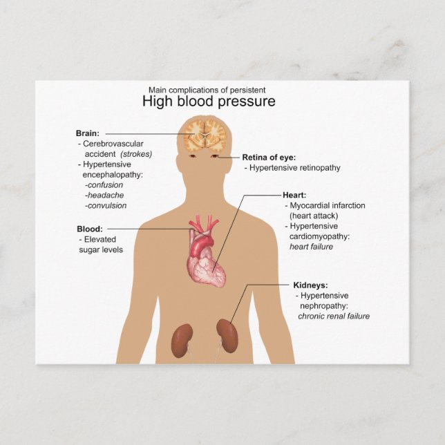 Main Complications of High Blood Pressure Chart Postcard (Front)