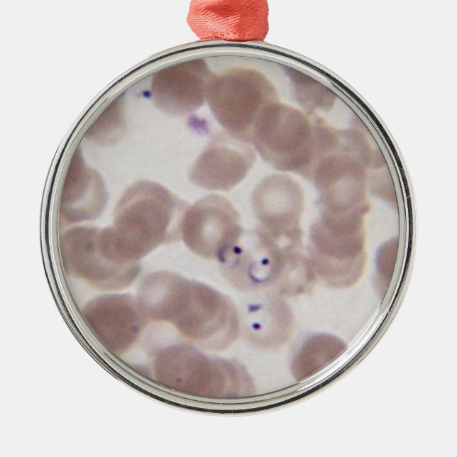 Malaria (Plasmodium) blood smear Metal Tree Decoration (Front)
