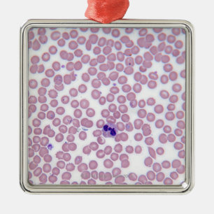 Malarial Blood Cells Metal Tree Decoration
