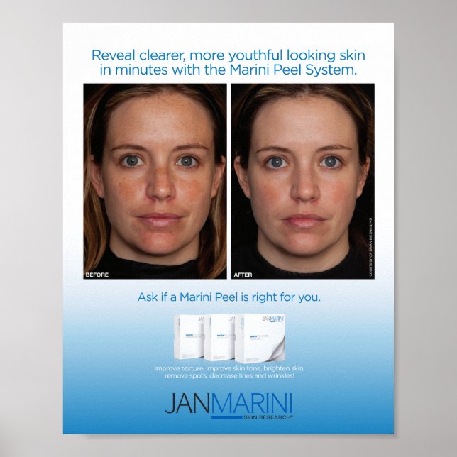 Marini Peel System 8x10" Poster (Front)