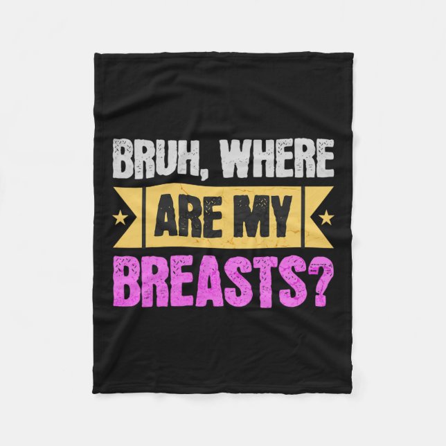 Mastectomy And Breast Reduction Surgery  Fleece Blanket (Front)