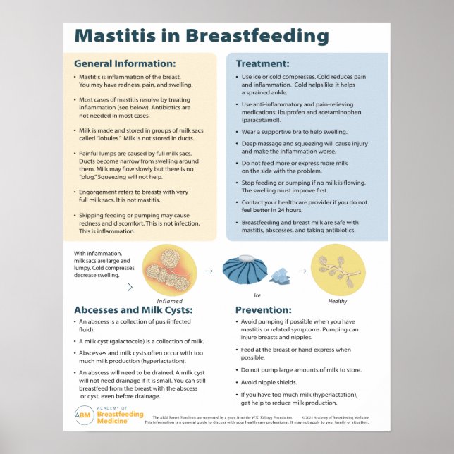 Mastitis in Breastfeeding Poster (English) (Front)
