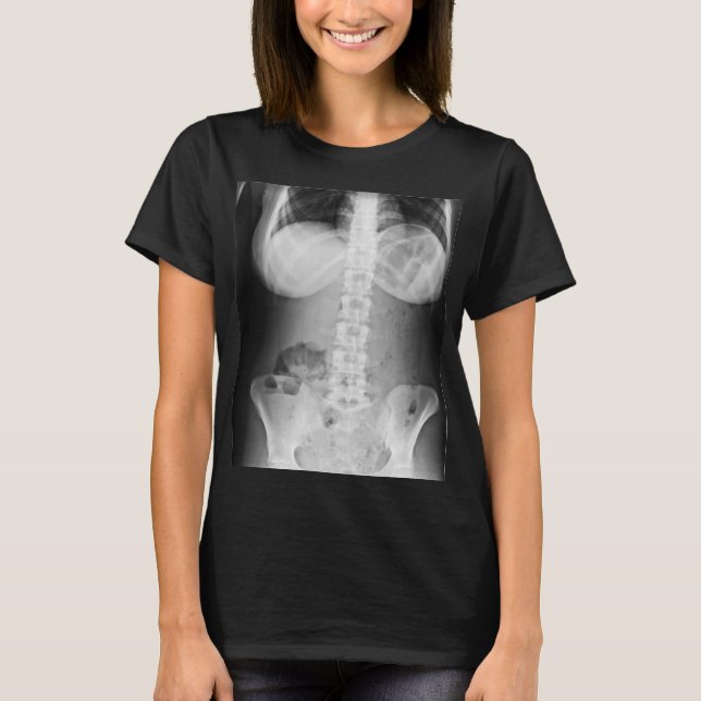 Medical Xray Photo human body anatomy T-Shirt (Front)