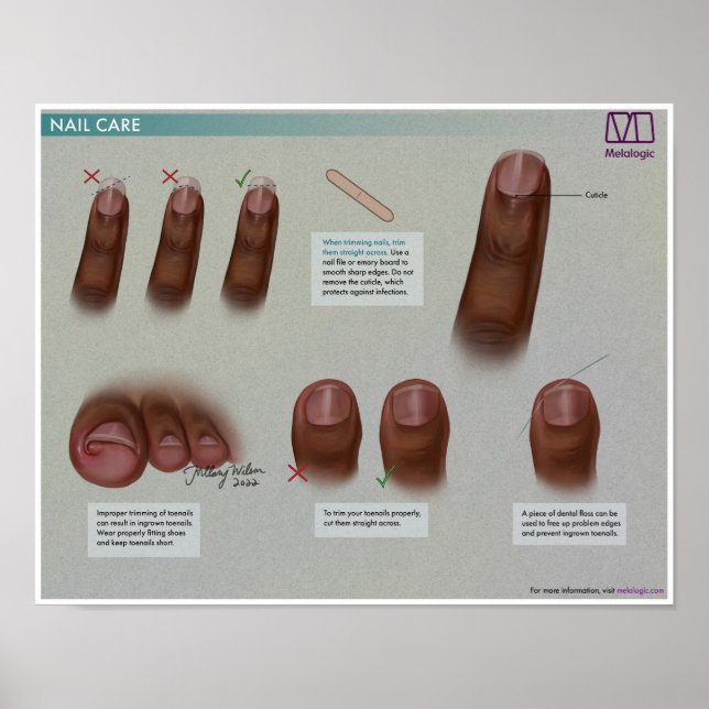 Melalogic Nail Care Medical Poster (Front)