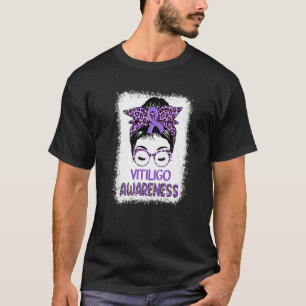 Messy Bun Girl Purple Ribbon Vitiligo Awareness T-Shirt