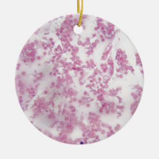 Microscope photo of human blood with Trypanosoma b Ceramic Tree Decoration