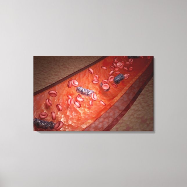 Microscopic rendering of a blood infection canvas print (Front)