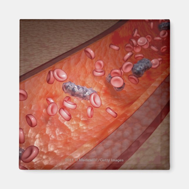 Microscopic rendering of a blood infection magnet (Front)