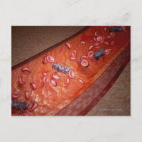 Microscopic rendering of a blood infection