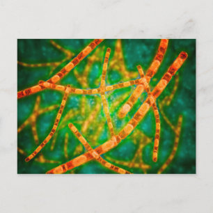 Microscopic View Of Anthrax 2 Postcard