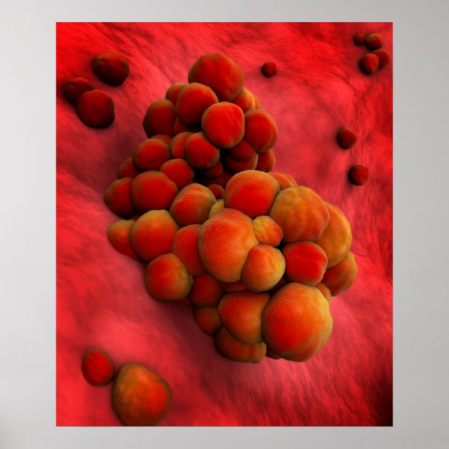 Microscopic View Of Tumor 2 Poster (Front)