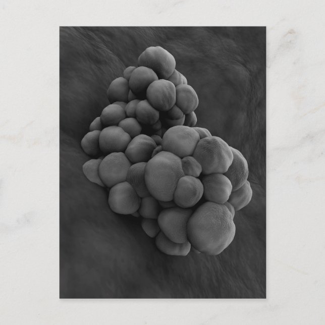 Microscopic View Of Tumour 1 Postcard (Front)