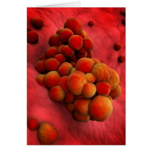 Microscopic View Of Tumour 2