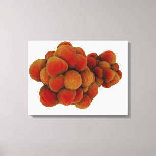 Microscopic View Of Tumour 4 Canvas Print