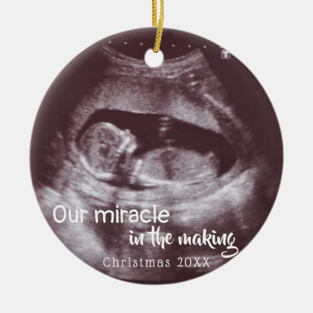 Miracle In Making Ultrasound 2 Photo Baby Announce Ceramic Tree Decoration (Front)