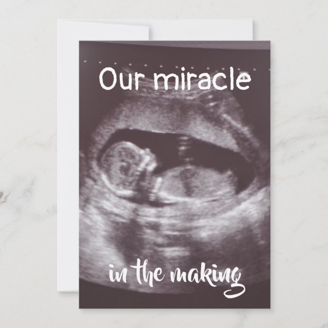 Miracle In Making Ultrasound 2 Photo Baby Family Announcement (Front)