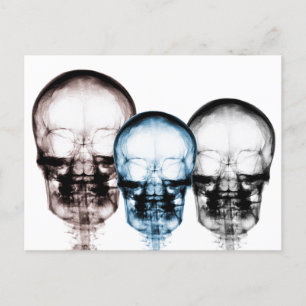Mixed Colours X-Ray Vision Skeleton Skulls Postcard