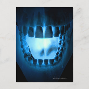 Mouth Area Postcard