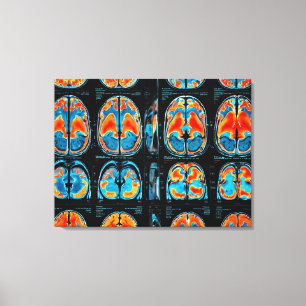 MRI brain scan Canvas Print