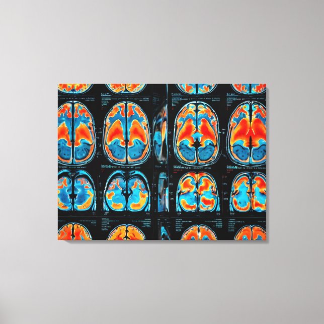 MRI brain scan Canvas Print (Front)