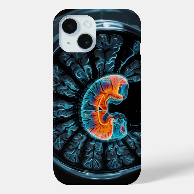 MRI brain scan Case-Mate iPhone Case (Back)