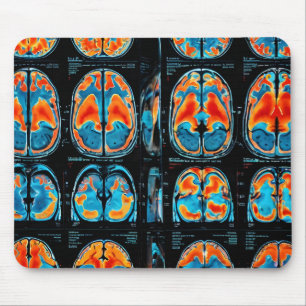 MRI brain scan Mouse Pad