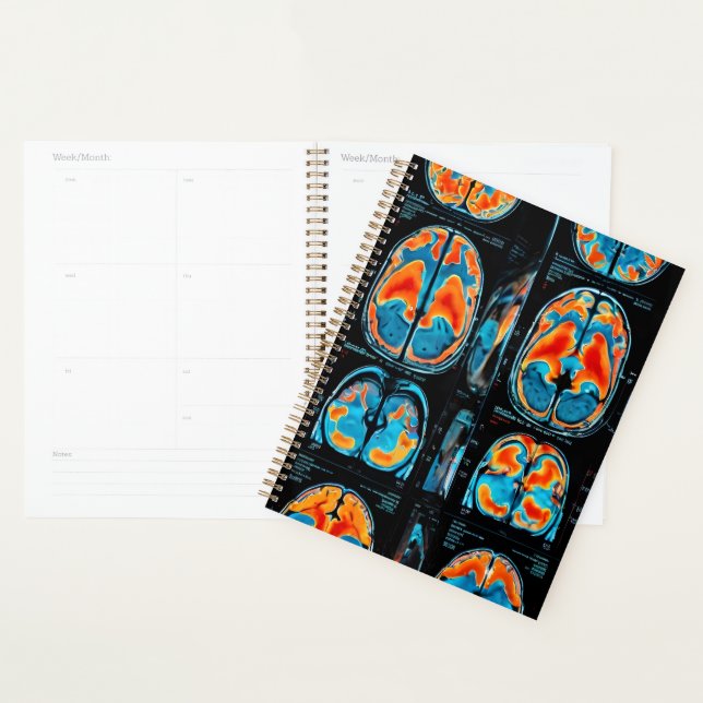 MRI brain scan Planner (Display)