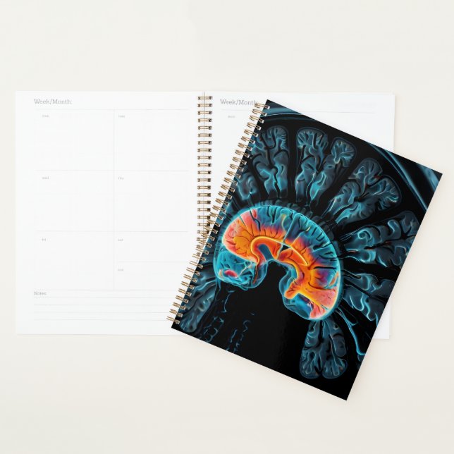 MRI brain scan Planner (Display)