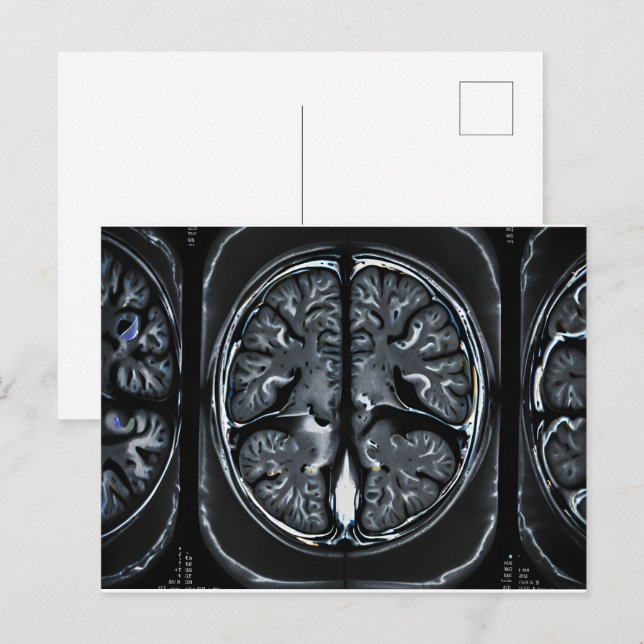 MRI brain scan Postcard (Front/Back)