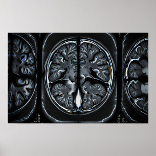 MRI brain scan Poster