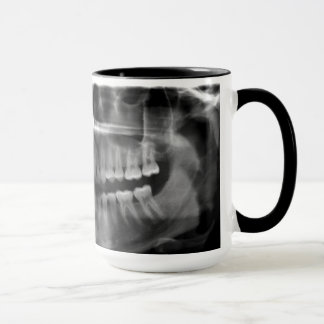 Mug Panoramic X-ray