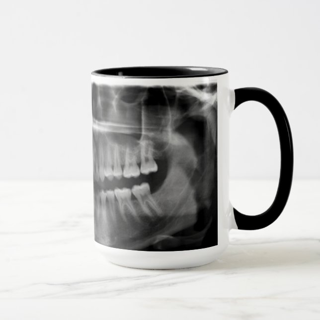 Mug X-ray Radiology (Right)