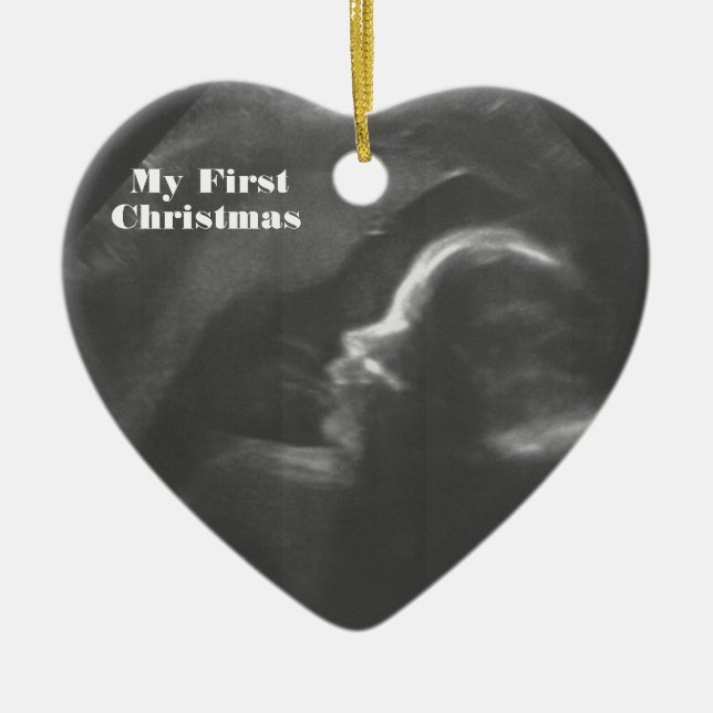 My First Christmas customizable Baby Scan Ceramic Tree Decoration (Front)