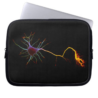 NeuroFlame (Plastic version) Laptop Sleeve