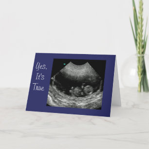 New Baby Anouncement Announcement