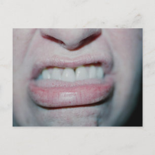 No Smiling Today Postcard