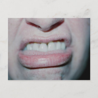 No Smiling Today Postcard