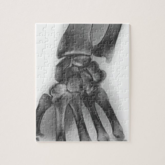 Normal wrist, X-ray Jigsaw Puzzle (Vertical)