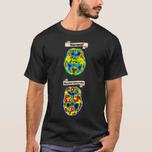 of Normal vs Bipolar brain scan T-Shirt