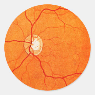 Ophthalmology Optometry Eye Fundus Exam Sticker
