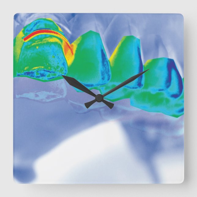 Original Teeth Design Dentist Wall Clock (Front)